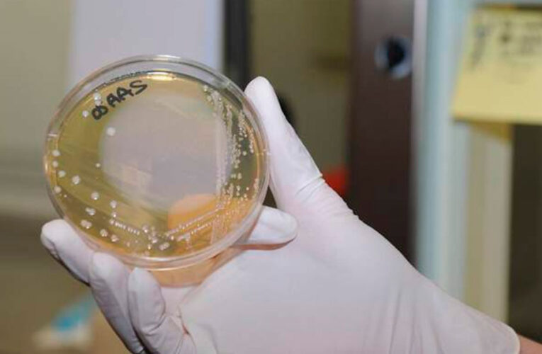 Alertan aumento de casos de una ‘bacteria carnívora’ que está afectando a Japón