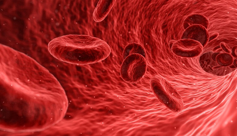 Laboratorios Chinoin presenta tratamiento contra la anemia por deficiencia de hierro y/o vitaminas