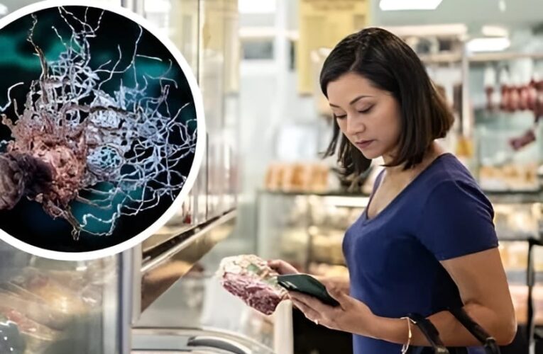 ALERTA: RETIRAN CARNES FRÍAS POR BROTE DE LISTERIA