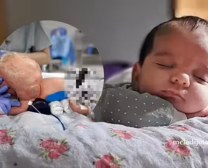 BEBÉ SUPERA CIRUGÍA MILAGROSA TRAS NACER CON TUMOR DE 2 KILOS