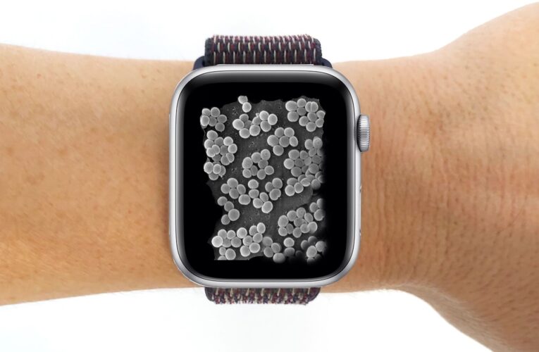 Estudio alerta: casi todas las correas de relojes inteligentes están contaminadas con bacterias